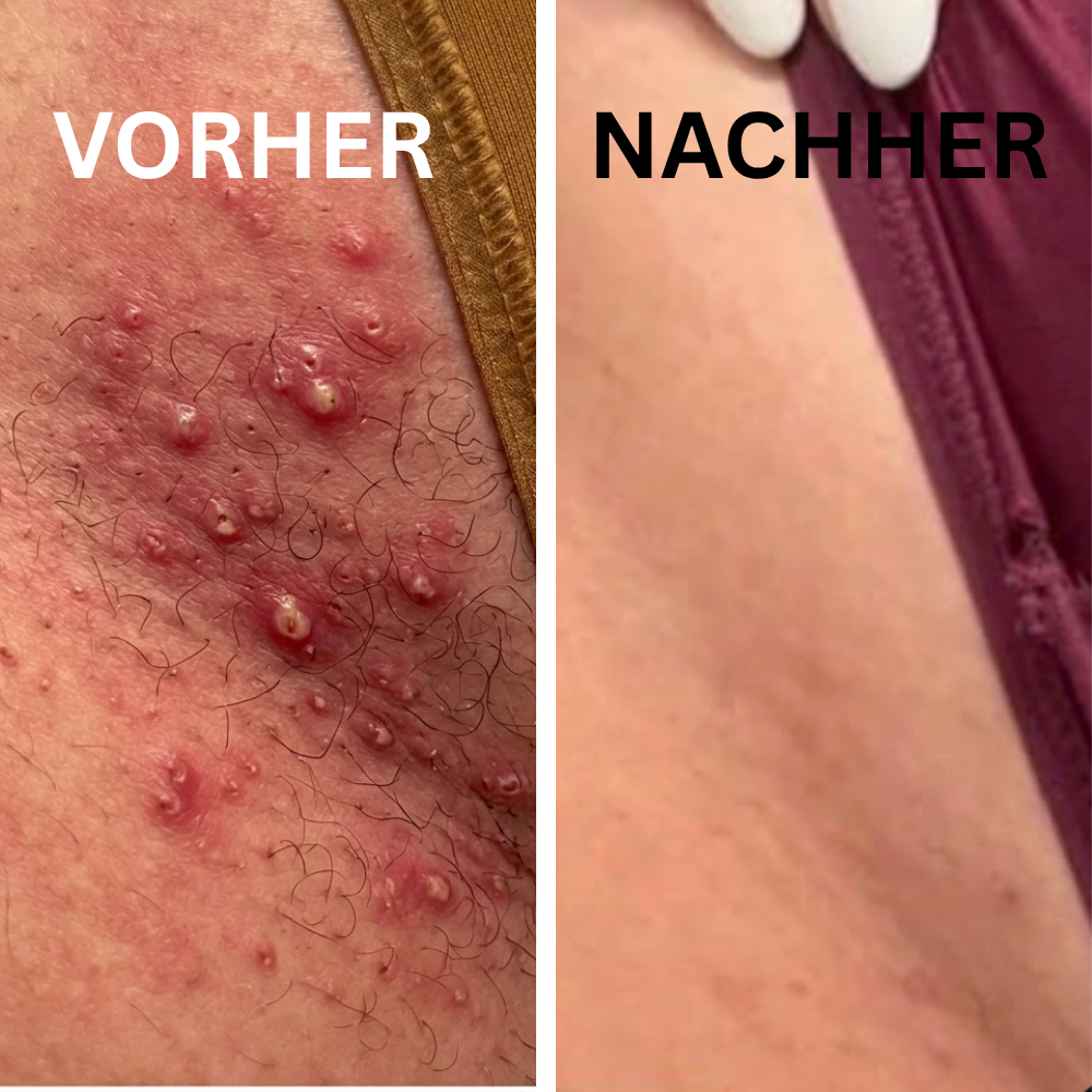Kavela - Cyperus Rotundus Haar Serum
