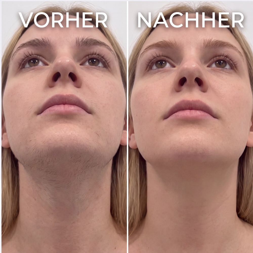 Kavela - Cyperus Rotundus Haar Serum